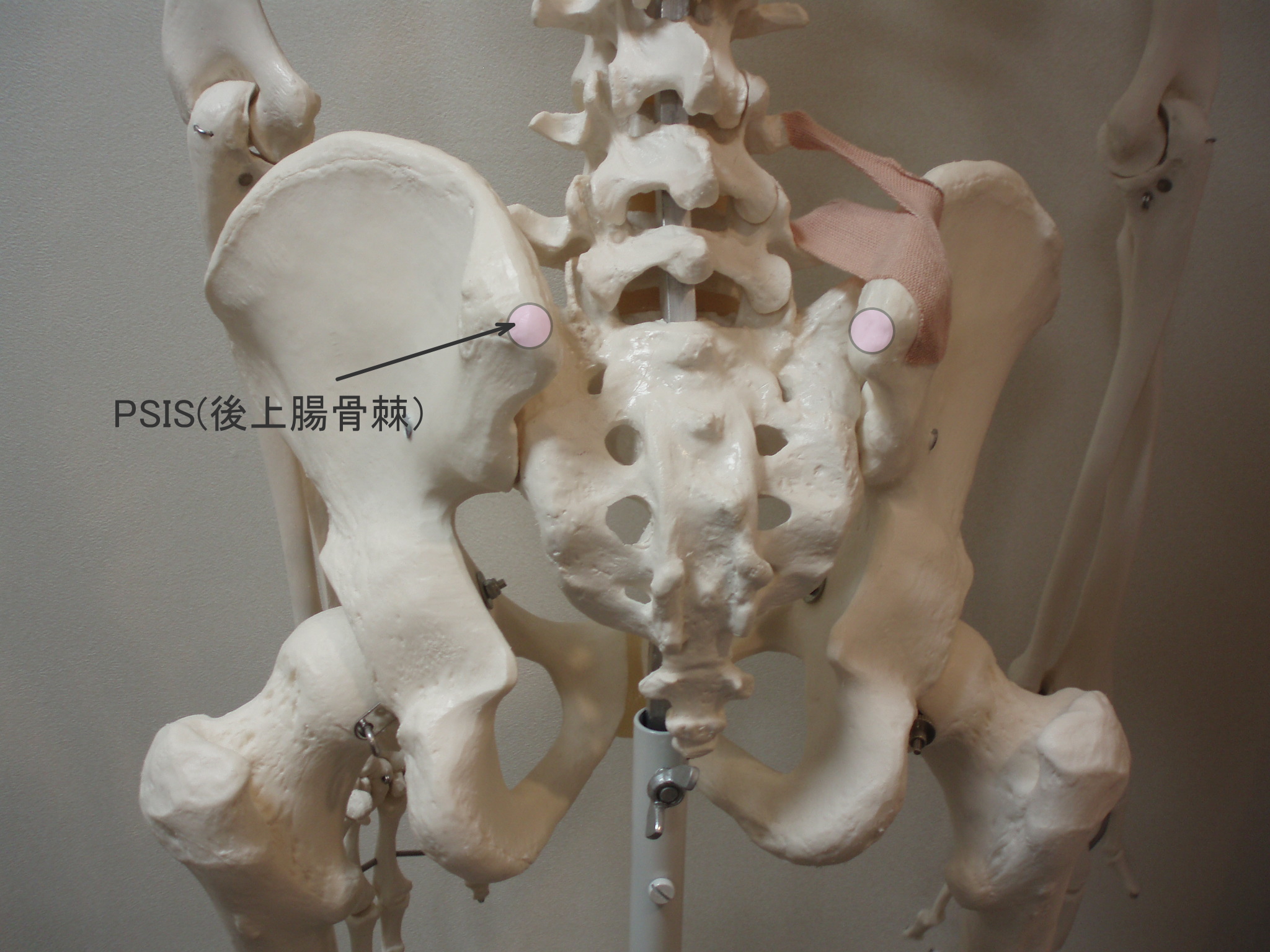 PSIS(後上腸骨棘)